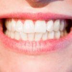 Ładne zdrowe zęby oraz olśniewający uroczy uśmieszek to powód do płenego uśmiechu.